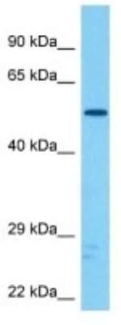 Stk-ps2 Rabbit anti-Mouse, Polyclonal, Novus Biologicals:Antibodies:Primary